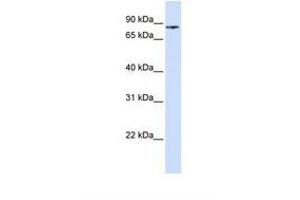 Image no. 1 for anti-Phosphoinositide-3-Kinase, Regulatory Subunit 5 (PIK3R5) (AA 110-159) antibody (ABIN6739038) (PIK3R5 Antikörper  (AA 110-159))