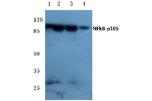 Western blot (WB) analysis of NFκB-p105 antibody at 1/500 dilution (NFKB1 Antikörper)