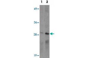 Western blot analysis of CD244 in Daudi cell lysate with CD244 polyclonal antibody  at (1) 1 and (2) 2 ug/mL. (2B4 Antikörper  (C-Term))