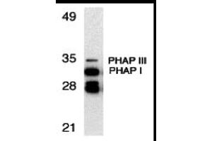 Western Blotting (WB) image for anti-Acidic (Leucine-Rich) Nuclear phosphoprotein 32 Family, Member A/B (ANP32A/ANP32B) (C-Term) antibody (ABIN1030577) (PHAP Antikörper  (C-Term))