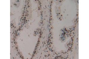 IHC-P analysis of Human Tissue, with DAB staining. (Ephrin A1 Antikörper  (AA 19-182))