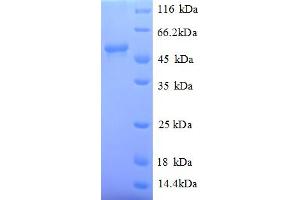 SDS-PAGE (SDS) image for Myc Proto-Oncogene protein (MYC) (AA 1-439), (full length) protein (His tag) (ABIN5709983)