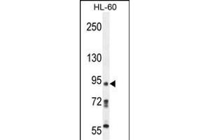 KRI1 Antibody (N-term) (ABIN654199 and ABIN2844048) western blot analysis in HL-60 cell line lysates (35 μg/lane).