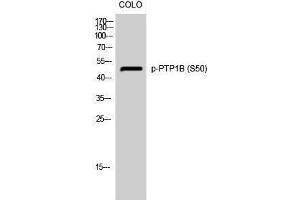 Western Blotting (WB) image for anti-Protein tyrosine Phosphatase, Non-Receptor Type 1 (PTPN1) (pSer50) antibody (ABIN3182605) (PTPN1 Antikörper  (pSer50))