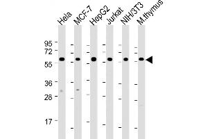 Western Blotting (WB) image for anti-Heat Shock 60kDa Protein 1 (Chaperonin) (HSPD1) (AA 340-374) antibody (ABIN6242389)