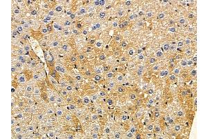 ABIN7094076 and ABIN7098120 at 1/100 staining mouse liver tissue by IHC-P. (ARMC10 Antikörper  (Internal Region))