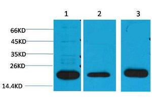 Western Blotting (WB) image for anti-Periaxin (PRX) antibody (ABIN3179015) (Periaxin Antikörper)