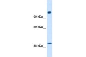 Western Blotting (WB) image for anti-Nuclear Receptor Co-Repressor 1 (NCOR1) antibody (ABIN2460482) (NCOR1 Antikörper)