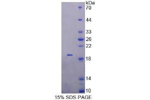 SDS-PAGE analysis of Mouse MTX1 Protein. (Metaxin 1 Protein (MTX1))