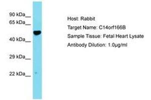Image no. 1 for anti-Chromosome 14 Open Reading Frame 166B (C14ORF166B) (AA 26-75) antibody (ABIN6750760) (C14orf166B Antikörper  (AA 26-75))
