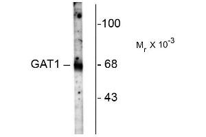 Western blots of rat hippocampal homogenate showing specific immunolabeling of the~ 67k GAT-1 protein. (SLC6A1 Antikörper  (C-Term))