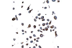 Immunocytochemistry (ICC) image for anti-Vimentin (VIM) (AA 325-375) antibody (ABIN7449539) (Rekombinanter Vimentin Antikörper  (AA 325-375))