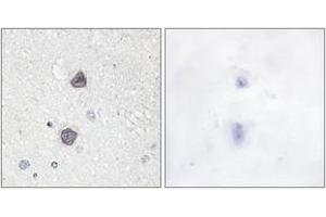 Immunohistochemistry analysis of paraffin-embedded human brain, using Aquaporin 2 (Phospho-Ser256) Antibody. (AQP2 Antikörper  (pSer256))