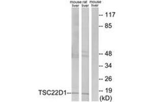 Western blot analysis of extracts from mouse liver/rat liver cells, using TSC22D1 Antibody.