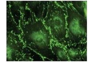 Immunostaining of primary RPE cells with CX43 Ab at 1/100 dilution. (Connexin 43/GJA1 Antikörper  (C-Term))