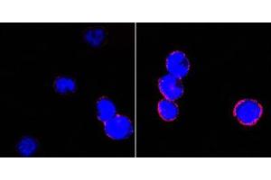 Confocal immunofluorescence analysis of BCBL-1 cells (left) and L1210 cells (right) using CD18 mouse mAb (red). (Integrin beta 2 Antikörper)