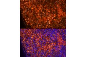 Immunofluorescence analysis of Rat spleen using CCL5/RANTES antibody (ABIN6129369, ABIN6138063, ABIN6138065 and ABIN6218473) at dilution of 1:100. (CCL5 Antikörper  (AA 24-91))