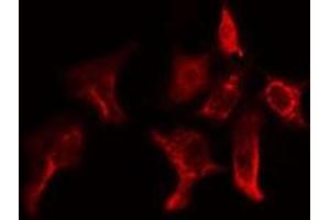 ABIN6275155 staining Hela cells by IF/ICC.