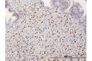 Immunoperoxidase of purified MaxPab antibody to RUNX3 on formalin-fixed paraffin-embedded human endometrium.