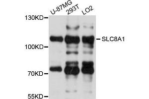Western blot analysis of extracts of various cells, using SLC8A1 antibody. (SLC8A1 Antikörper)