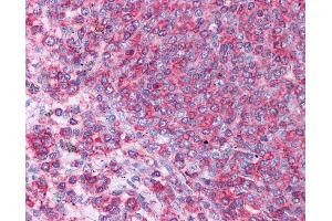 HSPA8 antibody was used for immunohistochemistry at a concentration of 4-8 ug/ml. (Hsc70 Antikörper  (N-Term))
