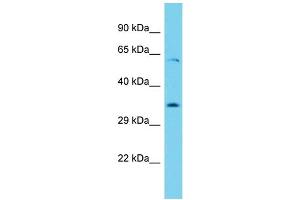 Host: Rabbit Target Name: Ythdf1 Sample Type: Rat Thymus lysates Antibody Dilution: 1.