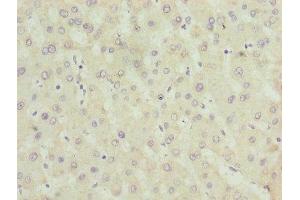 Immunohistochemistry of paraffin-embedded human liver tissue using ABIN7142596 at dilution of 1:100 (ALAS2 Antikörper  (AA 50-587))