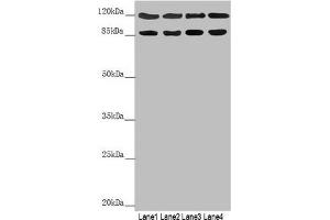 Western blot All lanes: SCYL1 antibody at 3. (SCYL1 Antikörper  (AA 460-740))