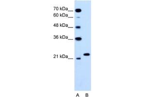 Western Blotting (WB) image for anti-RAB14, Member RAS Oncogene Family (RAB14) antibody (ABIN2463772) (RAB14 Antikörper)