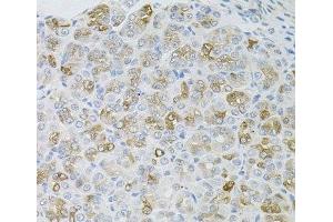 Immunohistochemistry of paraffin-embedded Mouse stomach using HPS1 Polyclonal Antibody at dilution of 1:100 (40x lens).