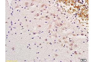 Formalin-fixed and paraffin embedded rat brain labeled with Anti-MSH gamma Polyclonal Antibody, Unconjugated (ABIN751123) at 1:200 followed by conjugation to the secondary antibody and DAB staining (gamma MSH (AA 51-150) Antikörper)