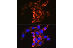 Immunofluorescence analysis of NIH/3T3 cells using Calpain 1 antibody (ABIN3021622, ABIN3021623, ABIN3021624, ABIN1512666 and ABIN6215416) at dilution of 1:100. (CAPNL1 Antikörper  (AA 20-330))