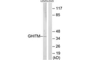 Western Blotting (WB) image for anti-Growth Hormone Inducible Transmembrane Protein (GHITM) (AA 31-80) antibody (ABIN2890353) (GHITM Antikörper  (AA 31-80))