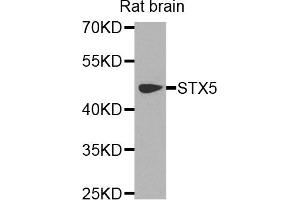 Western blot analysis of extracts of rat brain cells, using STX5 antibody. (Syntaxin 5 Antikörper)