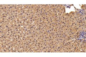 Immunohistochemistry (IHC) image for anti-Lipoprotein Lipase (LPL) (AA 28-474) antibody (ABIN7429373)