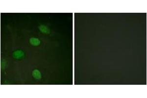 Immunofluorescence analysis of HeLa cells, using c-Jun (Phospho-Thr231) Antibody. (C-JUN Antikörper  (pThr231))
