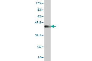 Western Blot detection against Immunogen (37. (PIK3C2B Antikörper  (AA 1-110))
