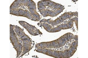 IHC analysis of UNG using anti UNG antibody (ABIN7602695). (UNG Antikörper  (AA 96-313))