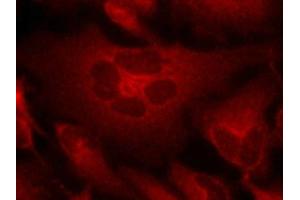 Immunofluorescence staining of methanol-fixed Hela cells using Bcr(Ab-177) Antibody. (BCR Antikörper)