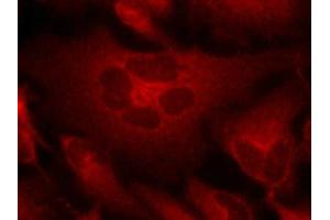 Immunofluorescence staining of methanol-fixed Hela cells using Bcr(Ab-177) Antibody. (BCR Antikörper)