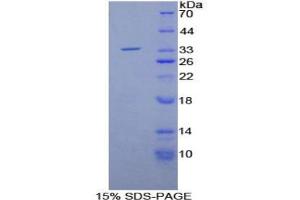 SDS-PAGE analysis of Rat Matrix Metalloproteinase 7 (MMP7) Protein. (MMP7 Protein)