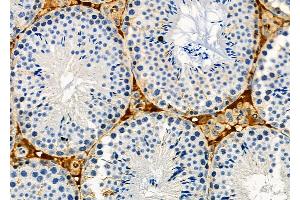 ABIN6262587 and ABIN6273127 at 1/100 staining Mouse testis tissue by IHC-P. (INHBA Antikörper  (Internal Region))