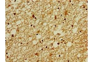 Immunohistochemistry of paraffin-embedded human brain tissue using ABIN7176339 at dilution of 1:100 (ZNF488 Antikörper  (AA 1-200))