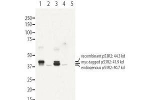 Image no. 1 for anti-Ribonucleotide Reductase M2 B (TP53 Inducible) (RRM2B) (N-Term) antibody (ABIN1104077) (RRM2B Antikörper  (N-Term))