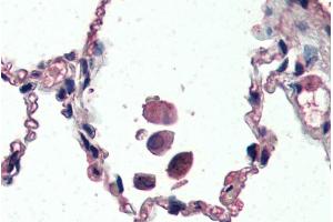 Immunohistochemistry (IHC) image for anti-Uncoupling Protein 2 (Mitochondrial, Proton Carrier) (UCP2) (Internal Region) antibody (ABIN5539644)