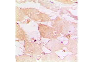 Immunohistochemical analysis of CD183 staining in human muscle formalin fixed paraffin embedded tissue section. (CXCR3 Antikörper  (Center))
