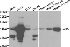 Western blot analysis of extracts of various cell lines, using ADA antibody. (ADA Antikörper)