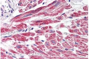 Human Heart (formalin-fixed, paraffin-embedded) stained with SNAI2 antibody ABIN214479 at 2. (SLUG Antikörper  (Internal Region))