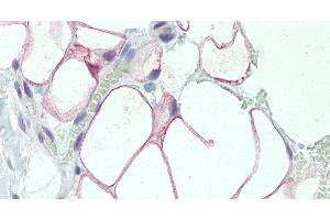 Immunohistochemistry of paraffin-embedded Adipose Tissue using DCBLD2 Polyclonal Antibody at dilution of 1:50. (DCBLD2 Antikörper)