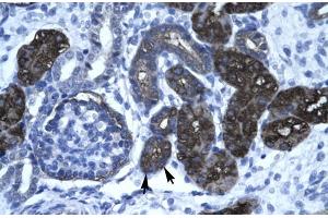 Human kidney; DKFZP761C169 antibody - N-terminal region in Human kidney cells using Immunohistochemistry (GC-Rich Promoter Binding Protein 1 (GPBP1) (N-Term) Antikörper)